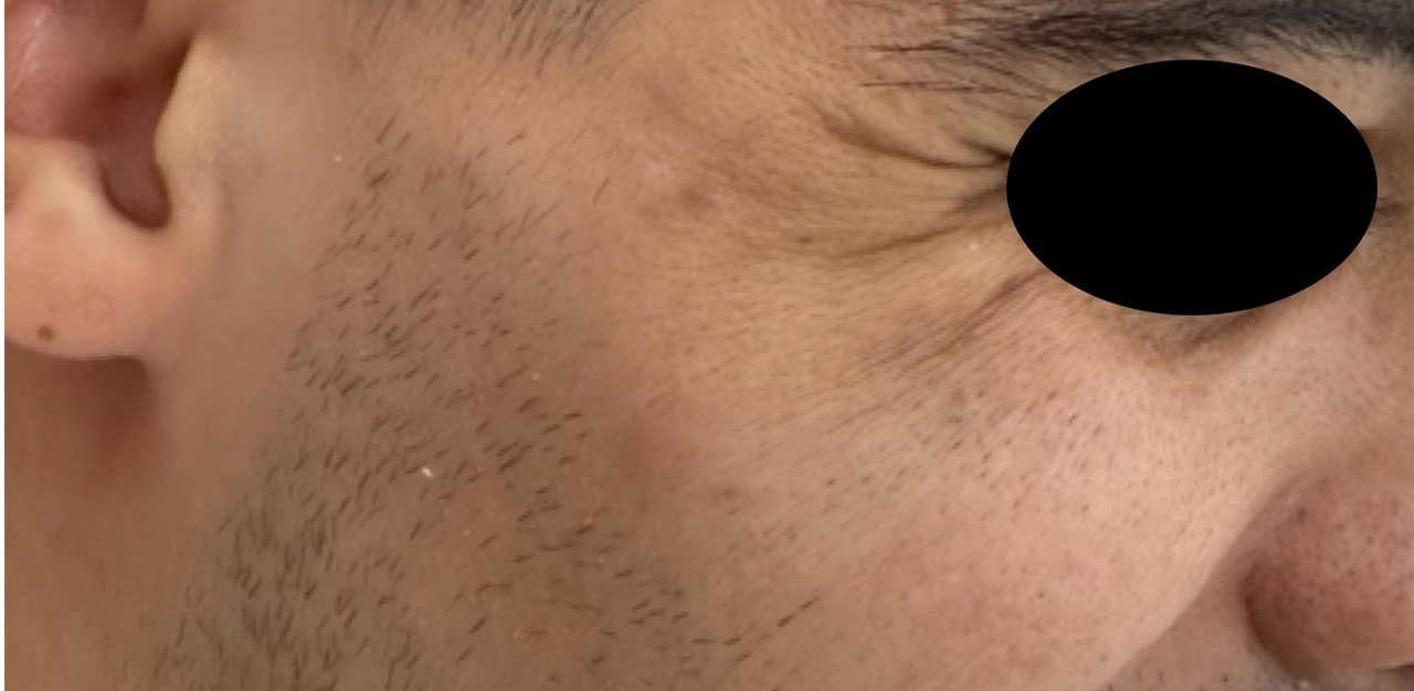 Before image alt