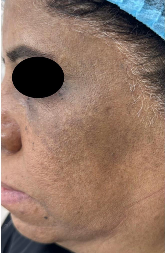 Before image alt